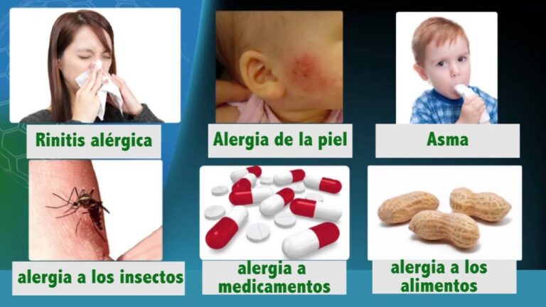 Elimina las alergias con las mejores pastillas del mercado